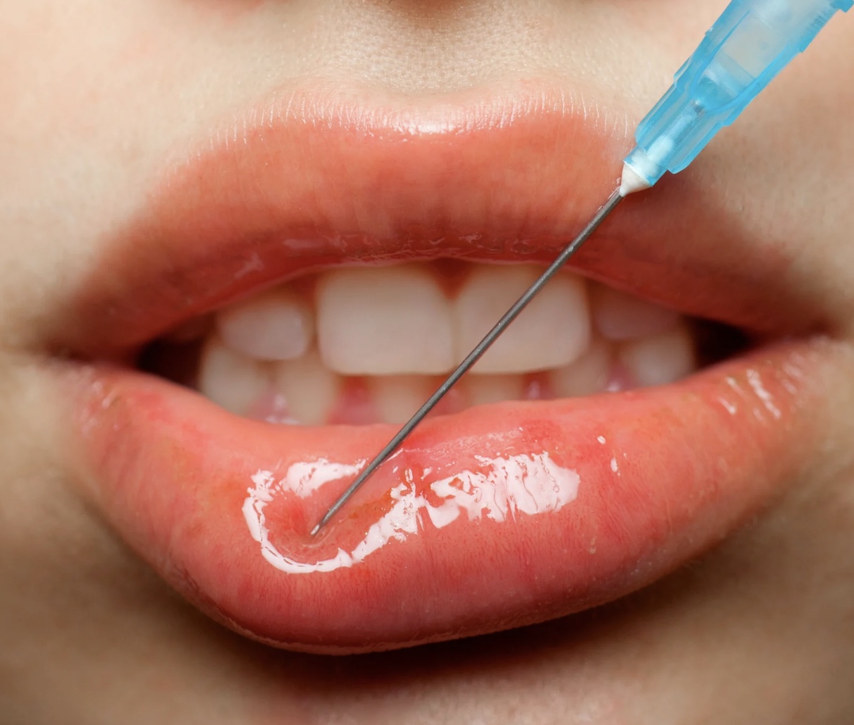 Imagem de 05-11-25 à(s) 03.33